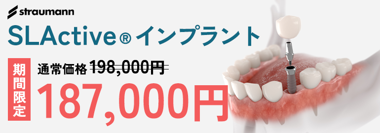 世界シェアNo,1メーカーの高性能インプラント straumannSLActive®インプラント
