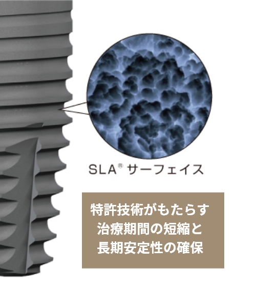 SLA®サーフェイス