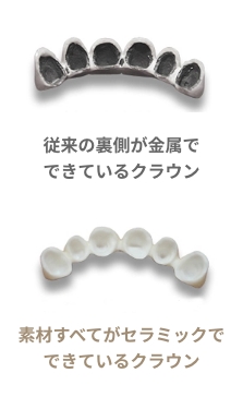 耐久性に優れた素材「ダイヤモンドセラミック」