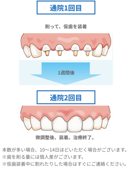 品川デンタルケアクリニックのセラミック治療