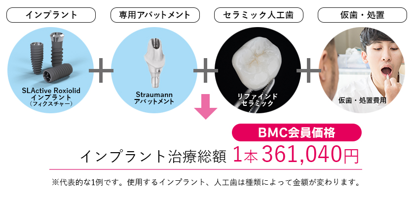 インプラントの治療総額 1本380,050円