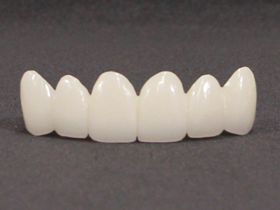 リファインドセラミック