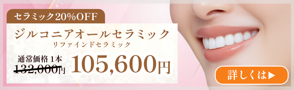 インプラント安心コミコミプランで1本総額297,000円