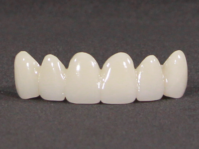 リファインドセラミック